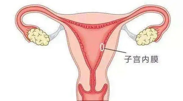 郑州不孕不育医院哪家好呢?子宫内膜息肉影响怀孕吗?